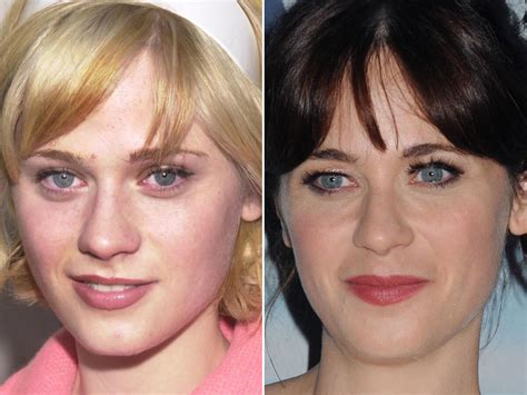 Zooey Deschanel Plastic Surgery: Then and Now Photos